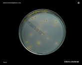 vibrio cholerae growth on TCBS agar